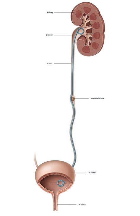 Dr Tim Nathan Urology | Insertion and Removal of Ureteric Stents