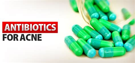 Banning Antibiotics for Acne | Probiotic Action