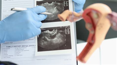 Normal Vs Polycystic Ovaries Ultrasound