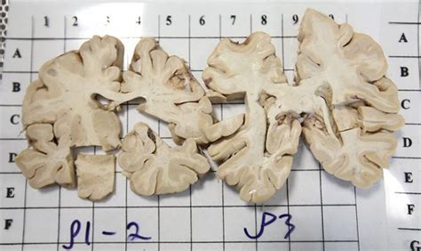 A human brain dissection – in pictures | Science | The Guardian Professor Aesthetic, Sci Fi ...