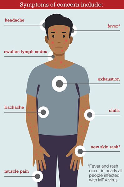 Monkeypox (mpox) - Franklin County Public Health