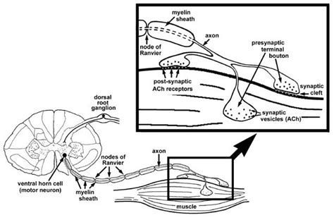 Are Fasciculations Upper Or Lower Motor Neuron - Infoupdate.org