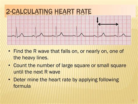 How To Calculate Heart Rate Through Ecg - Haiper