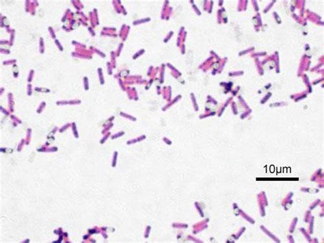 Enterobacter Aerogenes Gram Stain