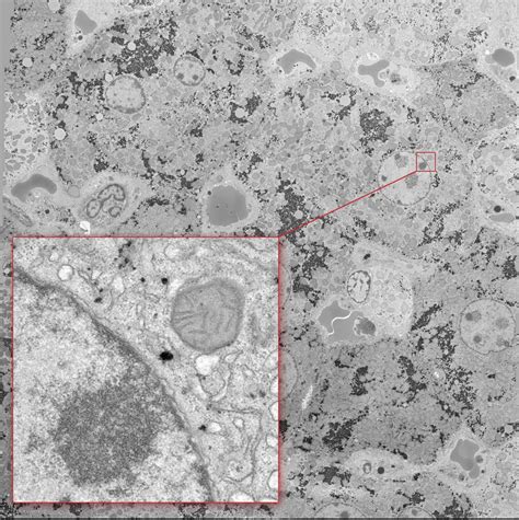 Examples in TEM high resolution – Electron Microscopy Facility