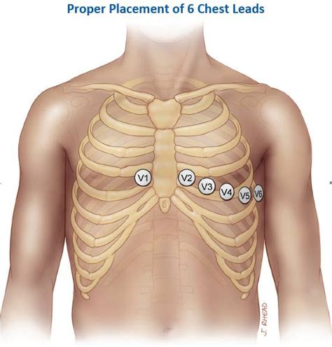 ECG Learning Center - An introduction to clinical electrocardiography