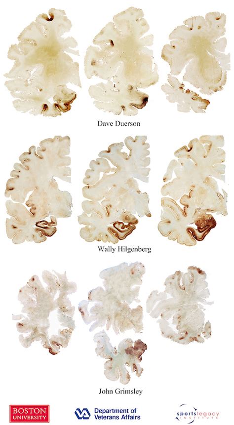 Figure 4: Dave Duerson, Wally Hilgenberg, and John Grimsley | BU ...