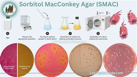 MacConkey Agar- Composition, Principle, Uses, Preparation, 56% OFF