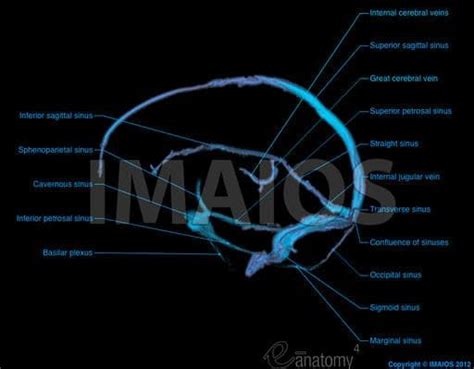 Dural venous sinuses: Superior sagittal sinus, Cavernous sinus, Sigmoid sinus | Magnetic ...