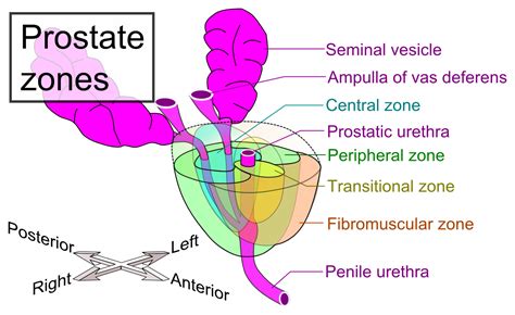 Prostate Cancer | Urology | Geeky Medics