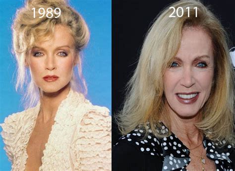 Chatter Busy: Donna Mills Plastic Surgery