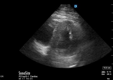 Echocardiography – UCSD Ultrasound