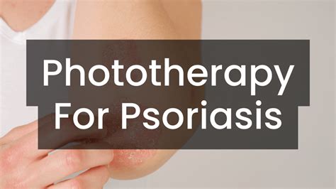 Phototherapy for Psoriasis – Care Lamps