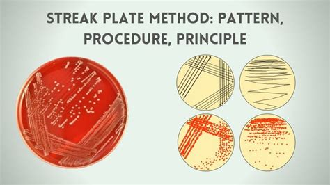 Streak Plate Method: Patterns, Procedure, Principle | Microbiology, Laboratory techniques ...