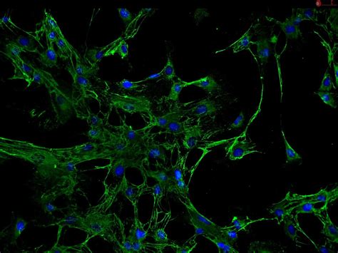 4200-SC | Human Renal Mesangial Cells (HRMC) (put into cell culture)