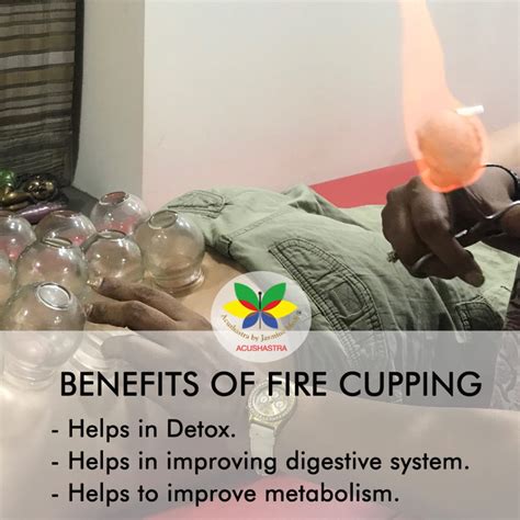 Benefit of fire cupping | Acupuncture by Jasmine Modi