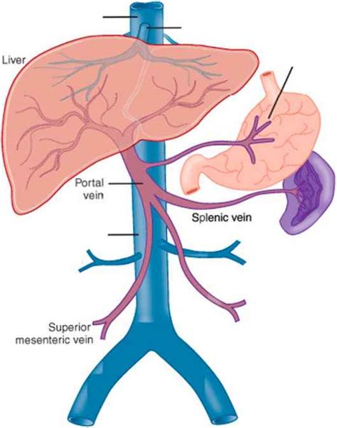 Ascites In Pathophysiology In Book - Pharmacotherapy Principles