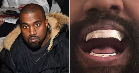 Kanye West debuts bizarre $850,000 titanium grills after having his teeth removed - The Mirror US