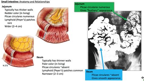 Ileum Anatomy - Anatomy Reading Source