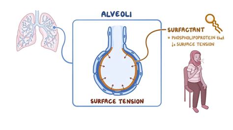 Alveolar surface tension and surfactant: Video | Osmosis