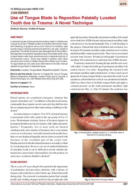 (PDF) Use of Tongue Blade to Reposition Palatally Luxated Tooth due to Trauma: A Novel Technique ...