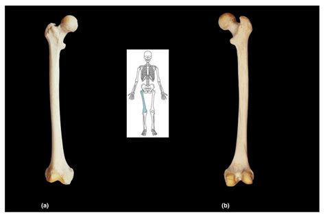 Femur Bone Markings Diagram | Quizlet