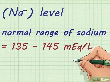 40+ Anion Gap Calculation Mdcalc - ErnestAnakeni