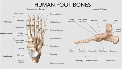 Plantar Fasciitis Vector Illustration Labeled Human Feet Disorder ...