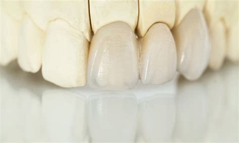 PFM vs. Zirconia: Which Material Is Best for Your Patient?