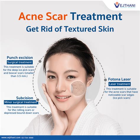 Get Rid of Textured Skin with Acne Scar Treatment @Vejthani Hospital