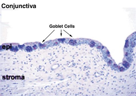 Bulbar Conjunctiva Histology