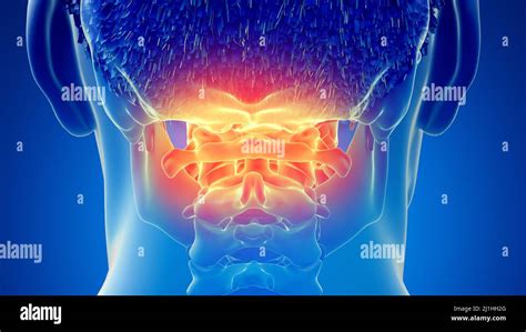 Painful atlas bone, illustration Stock Photo - Alamy