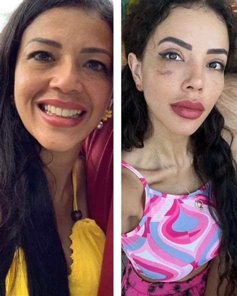 ‘90 Day Fiance’: Jasmine Pineda Plastic Surgery: Photos | Plastic surgery, Celebrity plastic ...