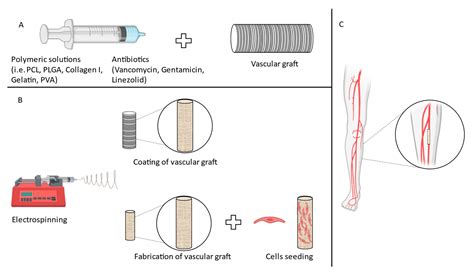 Fibers | Free Full-Text | Vascular Graft Infections: An Overview of Novel Treatments Using ...