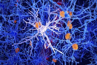 Microglia, the brain’s trash collector cells, may play larger role in brain health, may reveal ...