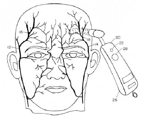 Scanning the temporal artery. | Download Scientific Diagram