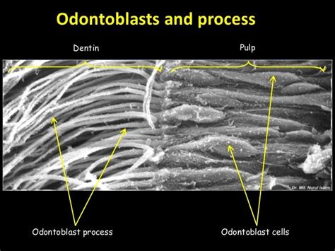 dentin pattern of mineralization, 1ry 2nd 3ry dentin formation and ro…