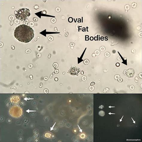 Pin από το χρήστη Bill στον πίνακα medizina | Microbiología, Urinarios ...