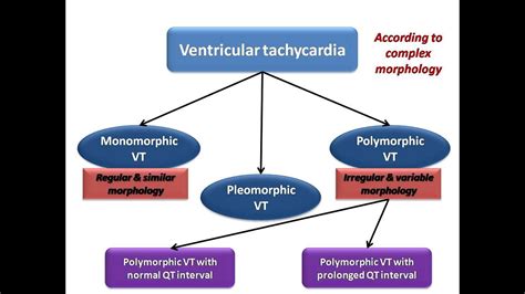 Monomorphic Vs Polymorphic Ventricular Tachycardia Strip