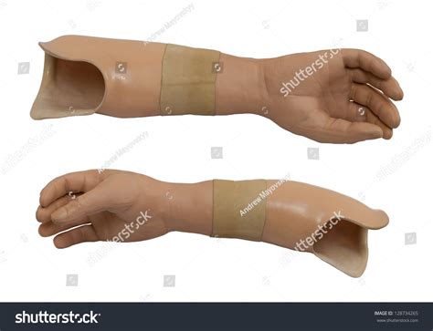 2,599 Prosthetic Arm Medical Images, Stock Photos, 3D objects, & Vectors | Shutterstock