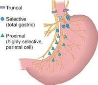 Our Parkinson's Place: Truncal but Not Selective Vagotomy May Protect Against Parkinson's