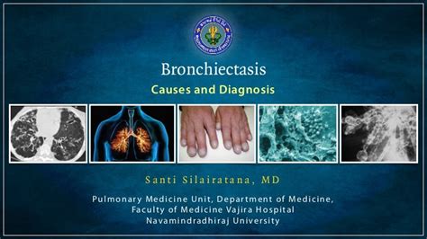 Bronchiectasis - causes and diagnosis