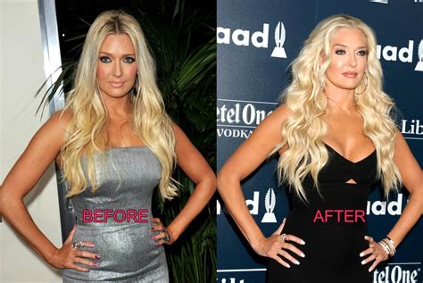 PHOTOS: See RHOBH's Erika Jayne Plastic Surgery Before & After Pics!