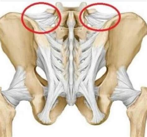 Anterior Iliac Crest Pain