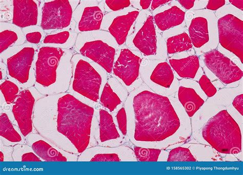 Histological Sample Striated Muscle Tissue Under the Microscope. Stock ...