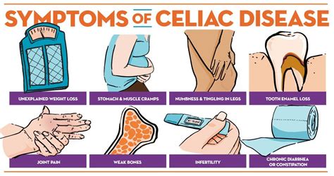 What Is Coeliac Disease Definition - PELAJARAN