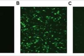 MIT works toward safer gene therapy | MIT News | Massachusetts Institute of Technology