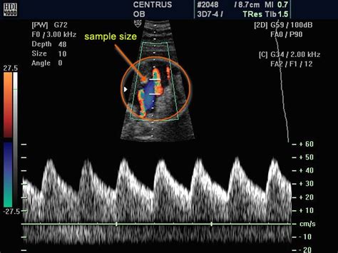 Doppler ultrasound: principles and practice | Ultrasound sonography, Diagnostic medical ...