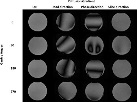 Frontiers | Tuning the optimal diffusion-weighted MRI parameters on a 0.35-T MR-Linac for ...