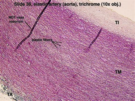 PPT - Slide 88, elastic artery (aorta), (10x obj.) PowerPoint Presentation - ID:5582075